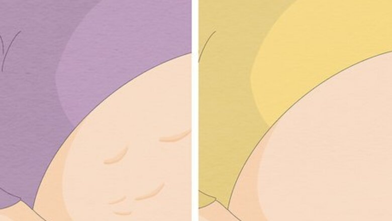 How to Get Rid of Cellulite With Exercise