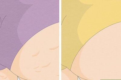 How to Get Rid of Cellulite With Exercise