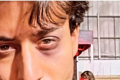 Tiger Shroff Injures Eye on Sets of Ganapath in the UK, Shares Photo
