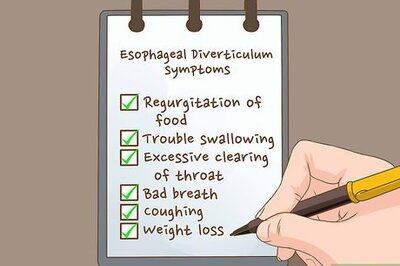 How to Treat Esophageal Diverticulum