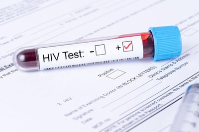HIV After One Exposure: Transmission, Risk Factors and Thereafter