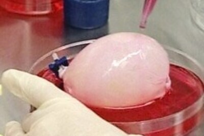 Bladder regeneration proves successful