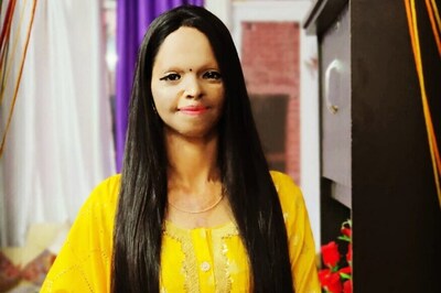 Chhapaak Hero Laxmi Agarwal is Now TikTok Star