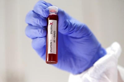 University of Hyderabad Faculty Develops Potential Vaccine Candidates Against Coronavirus