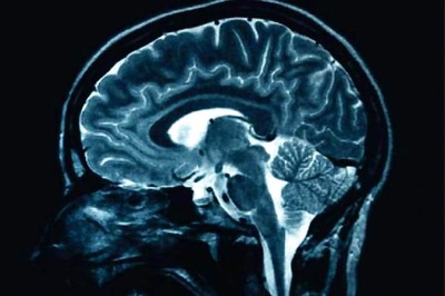 Middle-aged Women May Remember More Than Men