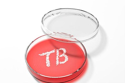 Worried Over TB Spike, India May Launch Door-to-Door Monitoring Mechanism