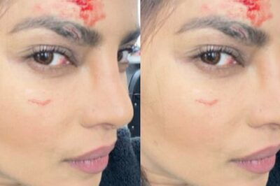 Priyanka Chopra Shares Photo From Citadel's Set, Asks Fans Whether Her Injury Marks Are Real