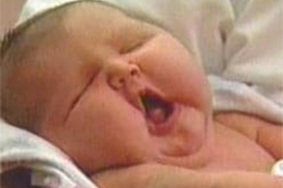 Having babies is tough for obese couples