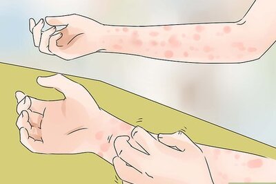 How to Avoid Skin Problems at Work