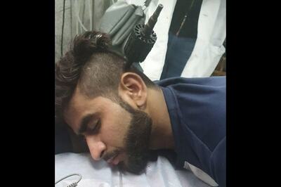 An Ordeal with Iron, Then a Miracle: The Man Who Had a Drill Pushed into His Head as Violence Raged in Delhi