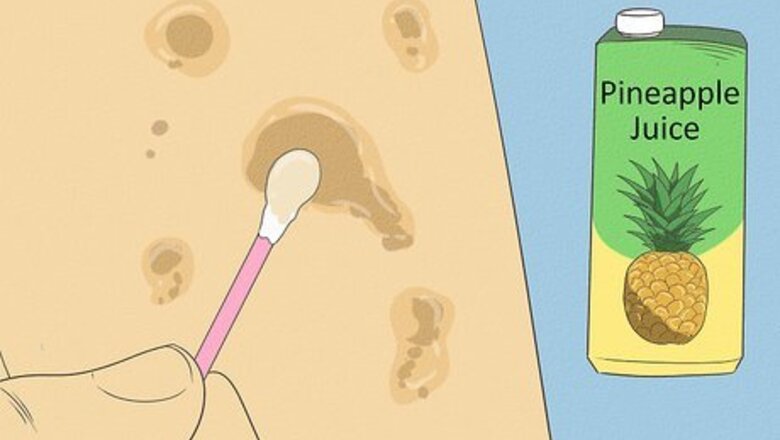 How to Get Rid of Spots on Your Skin
