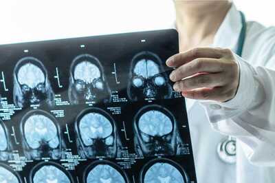 A New Study Describes How COVID-19 Damages The Brain