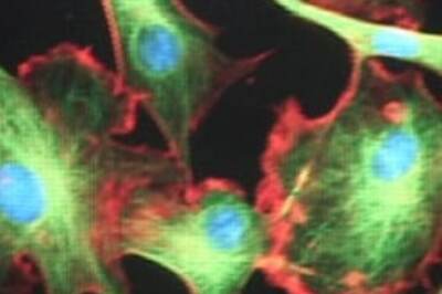 Scientists create part-human, part-animal embryos