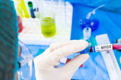 Mpox: Symptoms, Treatment And How It Is Different From Chickenpox, Smallpox