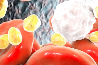 Rashes To Pimples, Changes High Cholesterol Levels Cause To Your Skin