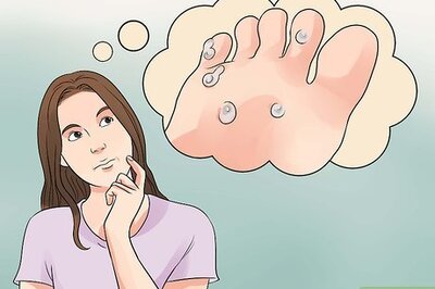 How to Treat Warts on Your Feet