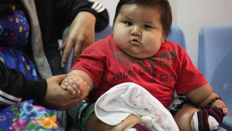 India is Malnourished Yet Obese. We Can't Feed Rice, Wheat to The Starving Who Need Eggs, Dals: Scientist