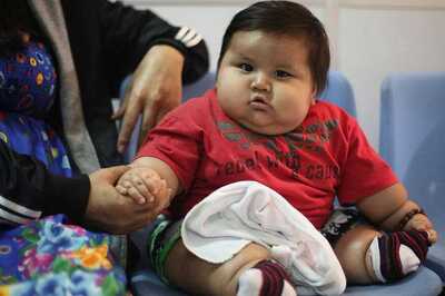 India is Malnourished Yet Obese. We Can't Feed Rice, Wheat to The Starving Who Need Eggs, Dals: Scientist