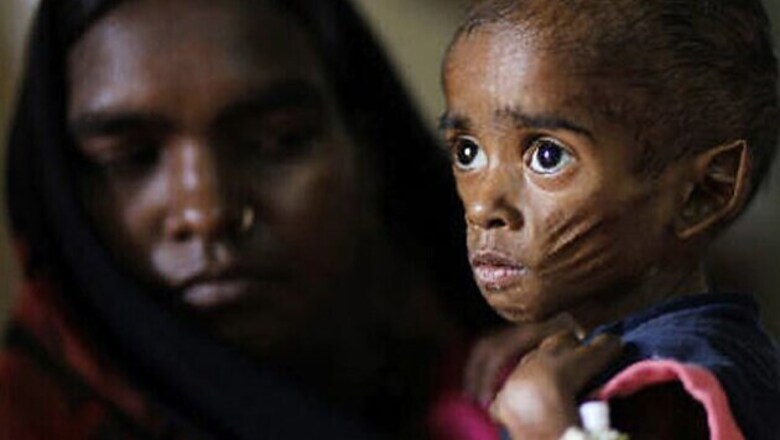 India records highest deaths among under-five children