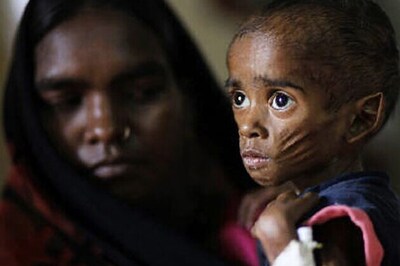 India records highest deaths among under-five children