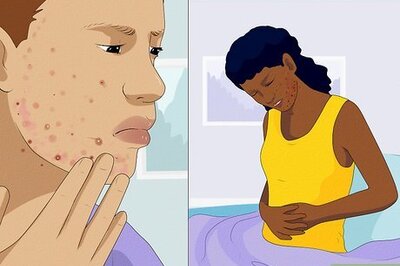 How to Treat Hormonal Acne: Ask a Dermatologist