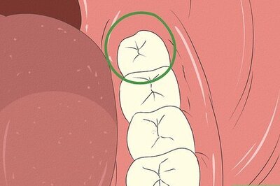 How to Tell Between an Erupting and Impacted Wisdom Tooth