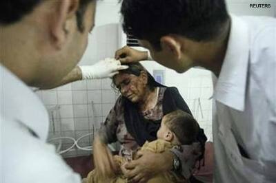 18 killed, 40 injured in suicide attack in Pak