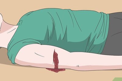 How to Apply a Tourniquet