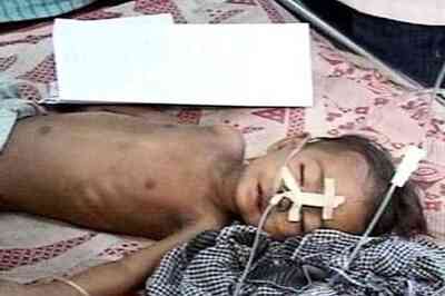 Chances of contracting encephalitis more in rural side: Doctor