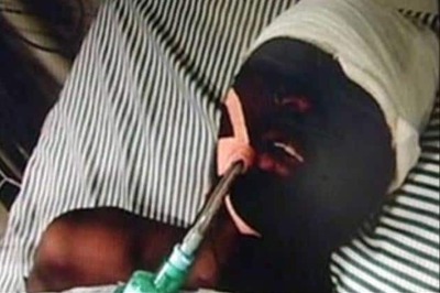 Burundi boy attack: Fourth accused arrested