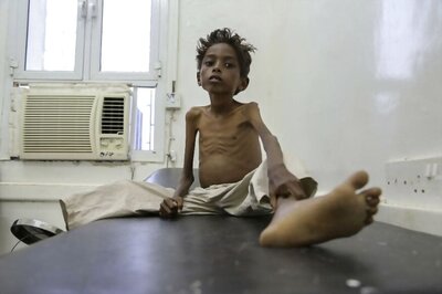 Grinding Civil War in Yemen Continues to Starve Children
