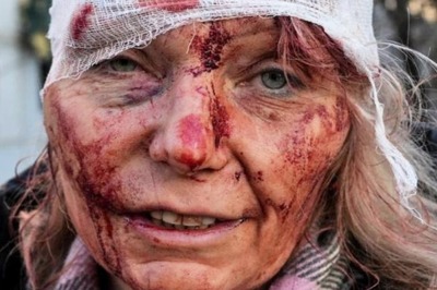 News18 Evening Digest: Ukrainian Teacher Who Survived Russian Missile Becomes Internet's 'Face of War' and Other Stories