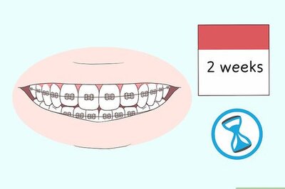 How to Kiss With Braces