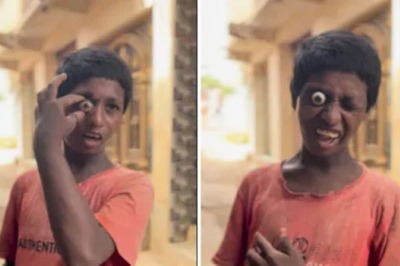 Watch: Boy Makes His Eye Come Out From The Socket