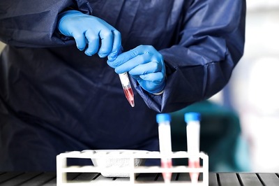 UP Records Highest Single-day Spike of 378 Covid-19 Cases, Tally Tops 8,000; Four More Die