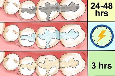 How to Care for a Tooth Filling