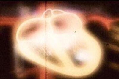 Transplant patients don't need medicines