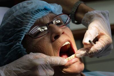 Poor Oral Health Escalates Risk of Chronic Diseases & Cancer : Study