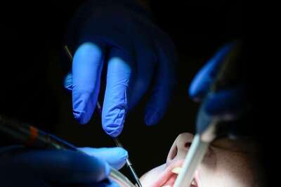 Chinese Man Dies Of Suspected Heart Attack 13 Days After Extracting 23 Teeth In A Single Day