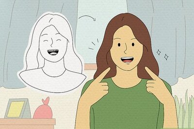 How to Prepare on the Day You Get Braces