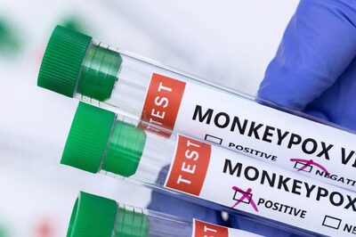 Rajasthan Reports First Suspected Case of Monkeypox, Samples Sent to NIV Pune