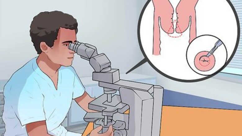 How to Treat Cervical Cancer
