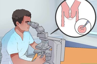 How to Treat Cervical Cancer