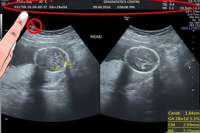 How to Read an Ultrasound Picture