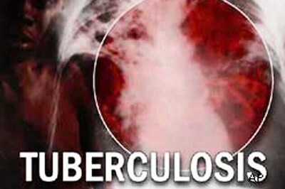 Fighting TB: Lessons learned and the way forward