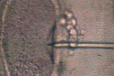 Relief for older women undergoing IVF