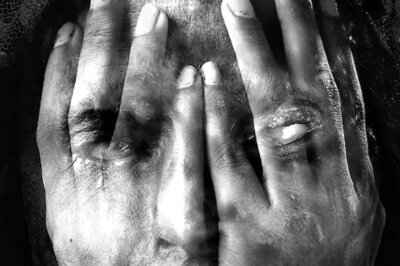 20 injured in Acid Attack in Bihar's Saran District Following Heated Argument Over Land Dispute