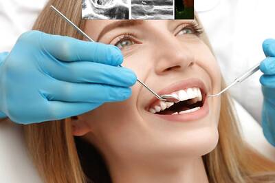 Dental Experts Lay Down Complications of Viral Turkey Teeth Trend