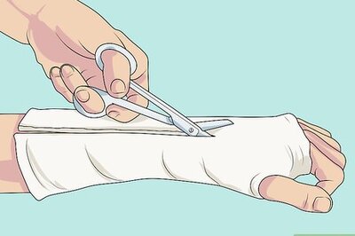 How to Make a Plaster Cast of an Arm