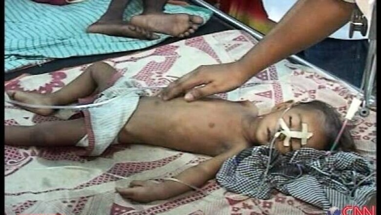 UP: Encephalitis kills 30 children in 5 days in Gorakhpur
